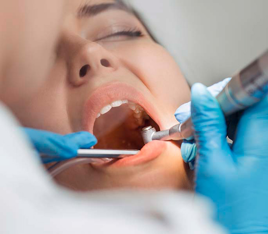 rofessionelle Zahnreinigung: Zahnarzt reinigt die Zähne einer Patientin
